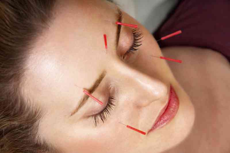 Traditionelle Chinesische Medizin Traditionelle Chinesische Medizin