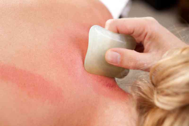 Traditionelle Chinesische Medizin Traditionelle Chinesische Medizin